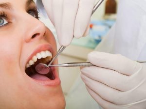 Lakukan Perawatan Gigi Ini Agar Manfaat Hidup Kamu Dapatkan